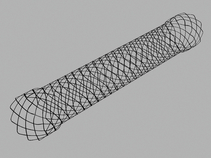 Evolution® Biliary Controlled-Release Stent - Uncovered