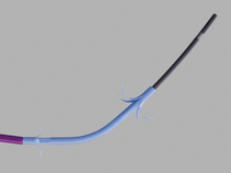 Oasis® One Action Stent Introduction System Preloaded with ST-2 Soehendra Tannenbaum® Biliary Stent