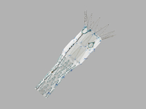 Zenith® Fenestrated AAA Endovascular Graft Proximal Body Graft
