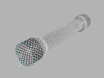 Evolution® Esophageal Controlled-Release Stent - Partially Covered