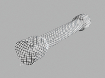 Evolution® Esophageal Controlled-Release Stent - Fully Covered