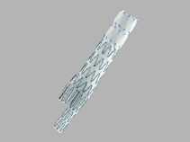 Zenith® Universal Distal Body Endovascular Graft